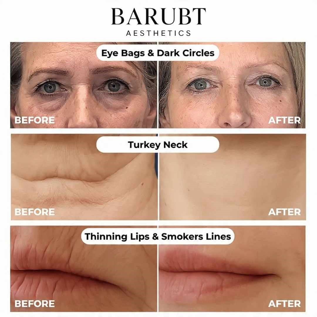 Anti-Aging Gold Silk Peptide Serum®