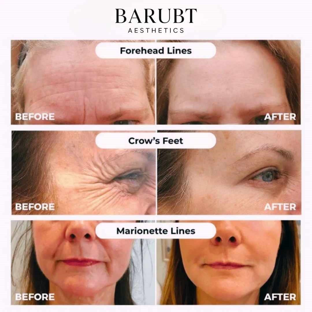 Anti-Aging Gold Silk Peptide Serum®